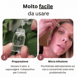 Micro Infusion