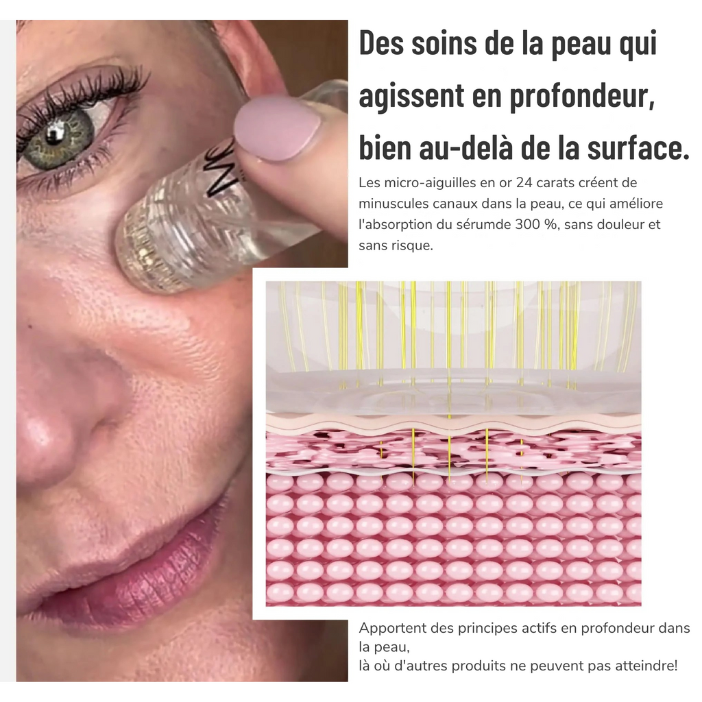 Micro Infusion